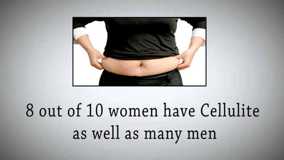 Get rid of cellulite with this amazing new technology...